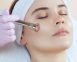 Particulate Skin Resurfacing Microdermabrasion